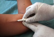 Aplican implantes subdérmicos gratuitos para para prevenir embarazos
